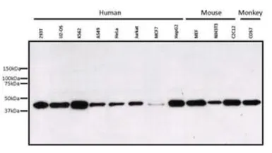 Anti-ERK1 antibody [12D11] used in Western Blot (WB). GTX15780