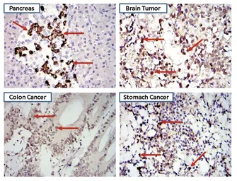 Anti-STAT3 antibody [9D8] used in IHC (Paraffin sections) (IHC-P). GTX15789
