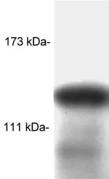 Anti-SRC1 antibody [1135/H4] used in Western Blot (WB). GTX15795