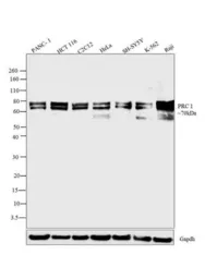 Anti-PRC1 antibody [16F2] used in Western Blot (WB). GTX15796