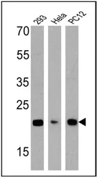 Anti-Diablo antibody [SMAC 17 1-87] used in Western Blot (WB). GTX15827