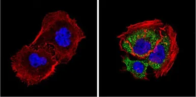 Anti-Diablo antibody [SMAC 17 1-87] used in Immunocytochemistry/ Immunofluorescence (ICC/IF). GTX15827