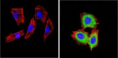 Anti-CD26 antibody [236.3] used in Immunocytochemistry/ Immunofluorescence (ICC/IF). GTX15833