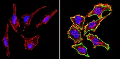 Anti-CD44 antibody [1M7.8.1] used in Immunocytochemistry/ Immunofluorescence (ICC/IF). GTX15834