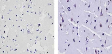Anti-Synaptojanin 1 antibody [AC1] used in IHC (Paraffin sections) (IHC-P). GTX15835