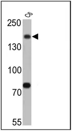 Anti-Synaptojanin 1 antibody [AC1] used in Western Blot (WB). GTX15835