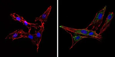 Anti-Synaptojanin 1 antibody [AC1] used in Immunocytochemistry/ Immunofluorescence (ICC/IF). GTX15835