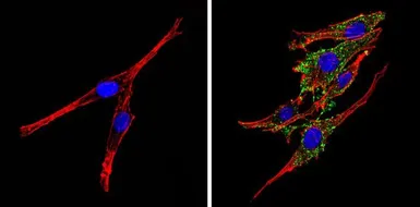 Anti-Synaptojanin 1 antibody [AC1] used in Immunocytochemistry/ Immunofluorescence (ICC/IF). GTX15835