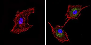 Anti-Synaptojanin 1 antibody [AC1] used in Immunocytochemistry/ Immunofluorescence (ICC/IF). GTX15835