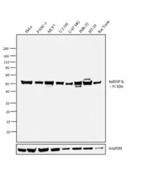 Anti-hnRNP K antibody [F45 P9 C7] used in Western Blot (WB). GTX15882