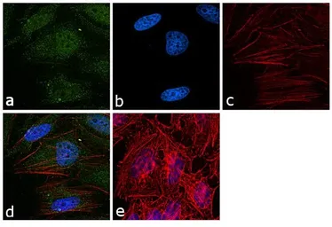 Anti-hnRNP K antibody [F45 P9 C7] used in Immunocytochemistry/ Immunofluorescence (ICC/IF). GTX15882