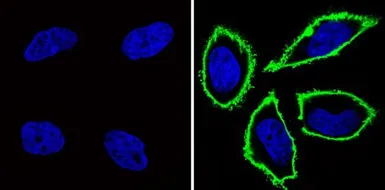 Anti-CD44 antibody [Hermes-1] used in Immunocytochemistry/ Immunofluorescence (ICC/IF). GTX15883