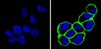 Anti-CD44 antibody [Hermes-1] used in Immunocytochemistry/ Immunofluorescence (ICC/IF). GTX15883