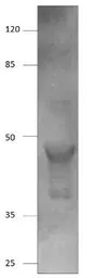 Anti-AMACR antibody used in Western Blot (WB). GTX15893