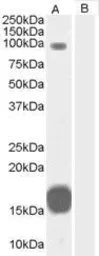 Anti-GRAF antibody, C-term used in Western Blot (WB). GTX15916