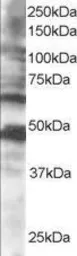 Anti-CPEB1 antibody, C-term used in Western Blot (WB). GTX15917