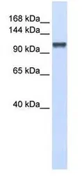 Anti-CHERP antibody used in Western Blot (WB). GTX15951