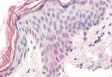 Anti-ZIC5 antibody, C-term used in IHC (Paraffin sections) (IHC-P). GTX15965