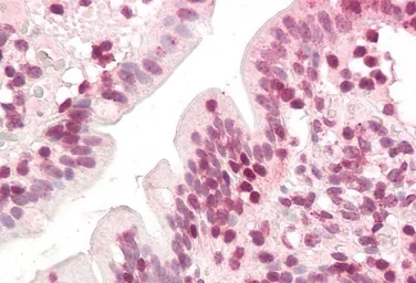 Anti-ZIC5 antibody, C-term used in IHC (Paraffin sections) (IHC-P). GTX15965