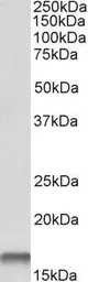 Anti-Cystatin B antibody, C-term used in Western Blot (WB). GTX15970