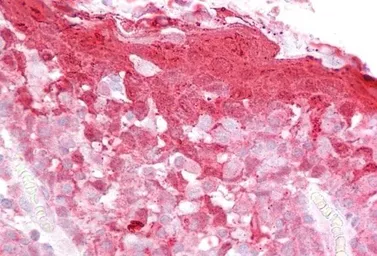 Anti-Cystatin B antibody, C-term used in IHC (Paraffin sections) (IHC-P). GTX15970