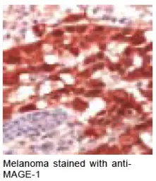 Anti-MAGE 1 antibody used in Immunohistochemistry (IHC). GTX16031