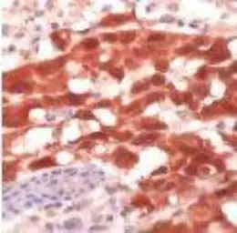 Anti-MAGE 1 antibody used in Immunohistochemistry (IHC). GTX16031