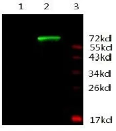 Anti-Androgen Receptor antibody [3C6-F12-F11] used in Western Blot (WB). GTX16032