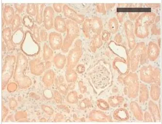 Anti-basic Cytokeratin antibody [AE3] used in IHC (Paraffin sections) (IHC-P). GTX16111