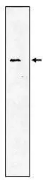 Anti-SRPR alpha antibody used in Western Blot (WB). GTX16145