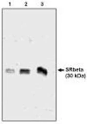 Anti-SRPR beta antibody used in Western Blot (WB). GTX16146