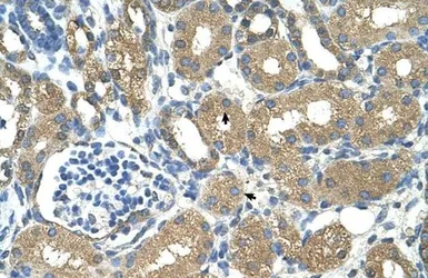 Anti-ADH4 antibody used in IHC (Paraffin sections) (IHC-P). GTX16238