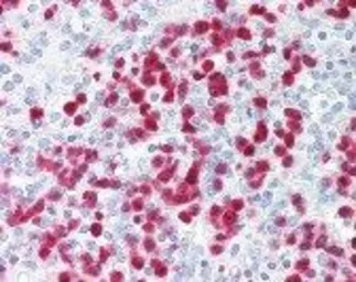 Anti-S100A8 antibody [CF-145] used in IHC (Paraffin sections) (IHC-P). GTX16249