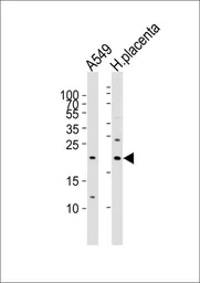 Anti-Epiregulin antibody used in Western Blot (WB). GTX16256