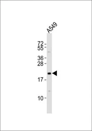 Anti-Epiregulin antibody used in Western Blot (WB). GTX16256