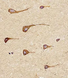 Anti-Epiregulin antibody used in IHC (Paraffin sections) (IHC-P). GTX16256