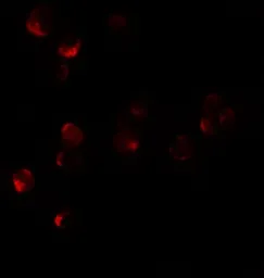 Anti-HIGD1A antibody used in Immunocytochemistry/ Immunofluorescence (ICC/IF). GTX16279