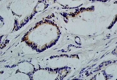 Anti-LLGL1 antibody used in IHC (Paraffin sections) (IHC-P). GTX16298