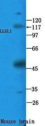 Anti-LLGL1 antibody used in Western Blot (WB). GTX16298