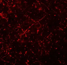 Anti-MS4A6A antibody used in IHC (Paraffin sections) (IHC-P). GTX16310