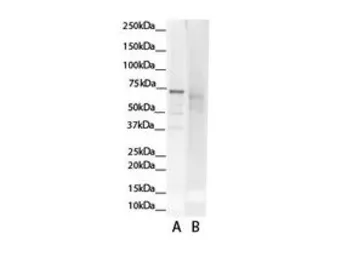 Anti-GCLC antibody, N-term used in Western Blot (WB). GTX16315
