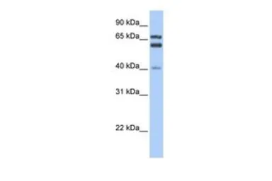 Anti-GCLC antibody, N-term used in Western Blot (WB). GTX16315