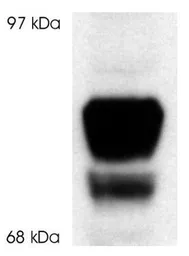 Anti-Glucocorticoid Receptor beta antibody used in Western Blot (WB). GTX16319