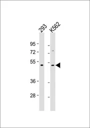 Anti-TGF beta 2 antibody [220ct16.4.3.1] used in Western Blot (WB). GTX16335