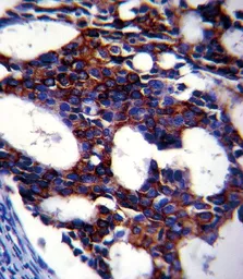 Anti-TGF beta 2 antibody [220ct16.4.3.1] used in IHC (Paraffin sections) (IHC-P). GTX16335