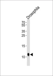 Anti-Sumo antibody used in Western Blot (WB). GTX16337