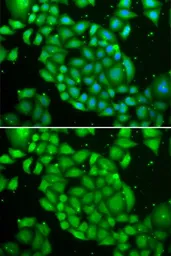 Anti-TCL1A antibody used in Immunocytochemistry/ Immunofluorescence (ICC/IF). GTX16378