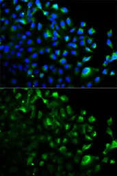 Anti-TRAF2 antibody used in Immunocytochemistry/ Immunofluorescence (ICC/IF). GTX16381
