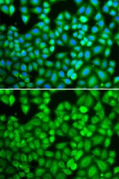 Anti-WASP antibody used in Immunocytochemistry/ Immunofluorescence (ICC/IF). GTX16382