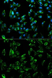 Anti-Tropomyosin 3 antibody used in Immunocytochemistry/ Immunofluorescence (ICC/IF). GTX16386